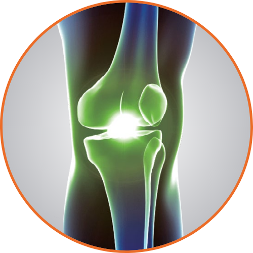 Monovisc injection therapy - Eos Active