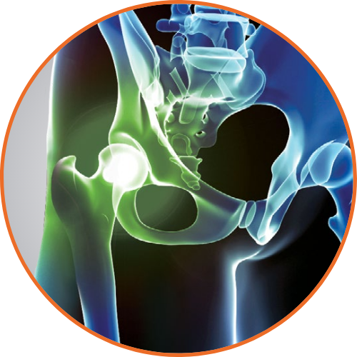 Monovisc injection therapy - Eos Active